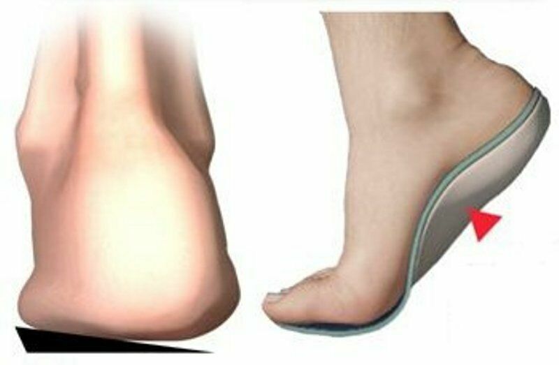 Insoles designed to relieve foot pain and discomfort